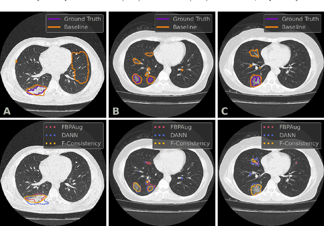 Figure 4 for Adaptation to CT Reconstruction Kernels by Enforcing Cross-domain Feature Maps Consistency