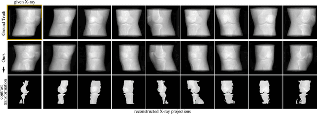 Figure 3 for MedNeRF: Medical Neural Radiance Fields for Reconstructing 3D-aware CT-Projections from a Single X-ray