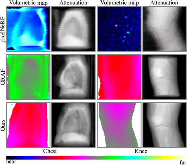 Figure 4 for MedNeRF: Medical Neural Radiance Fields for Reconstructing 3D-aware CT-Projections from a Single X-ray