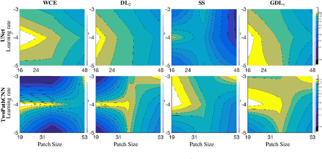 Figure 2 for Generalised Dice overlap as a deep learning loss function for highly unbalanced segmentations