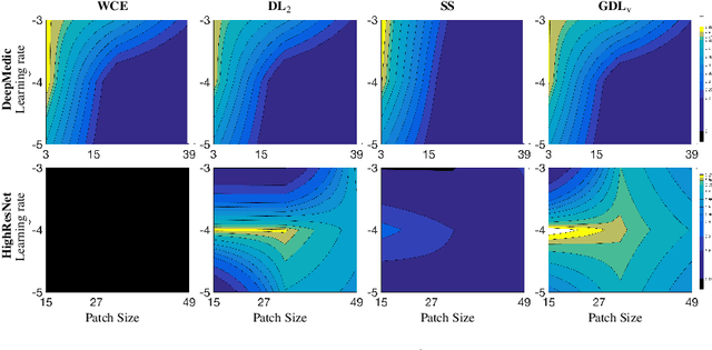 Figure 4 for Generalised Dice overlap as a deep learning loss function for highly unbalanced segmentations