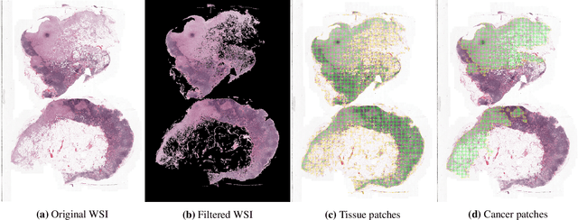 Figure 3 for Unsupervised Detection of Cancerous Regions in Histology Imagery using Image-to-Image Translation