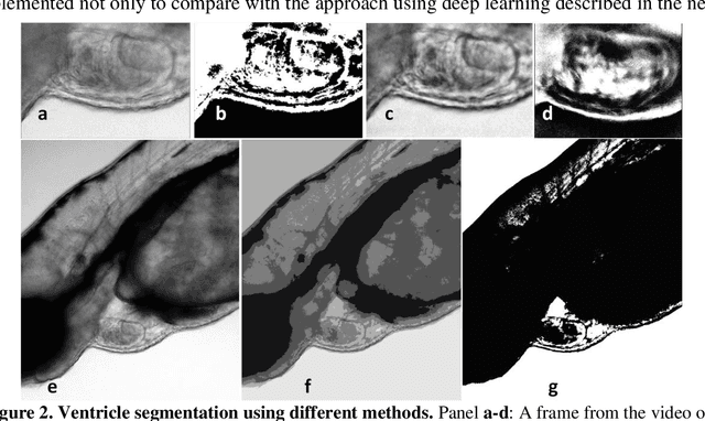 Figure 2 for Deep learning-based framework for cardiac function assessment in embryonic zebrafish from heart beating videos