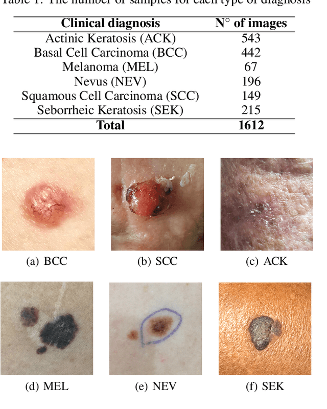 Figure 1 for The impact of patient clinical information on automated skin cancer detection
