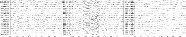 Figure 1 for Task-oriented Self-supervised Learning for Anomaly Detection in Electroencephalography