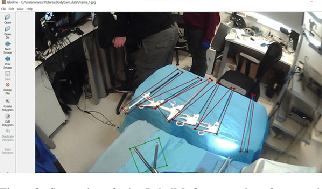 Figure 3 for Situation Awareness for Automated Surgical Check-listing in AI-Assisted Operating Room
