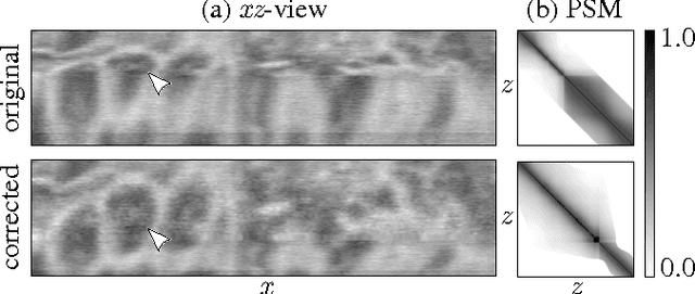 Figure 1 for Post-acquisition image based compensation for thickness variation in microscopy section series