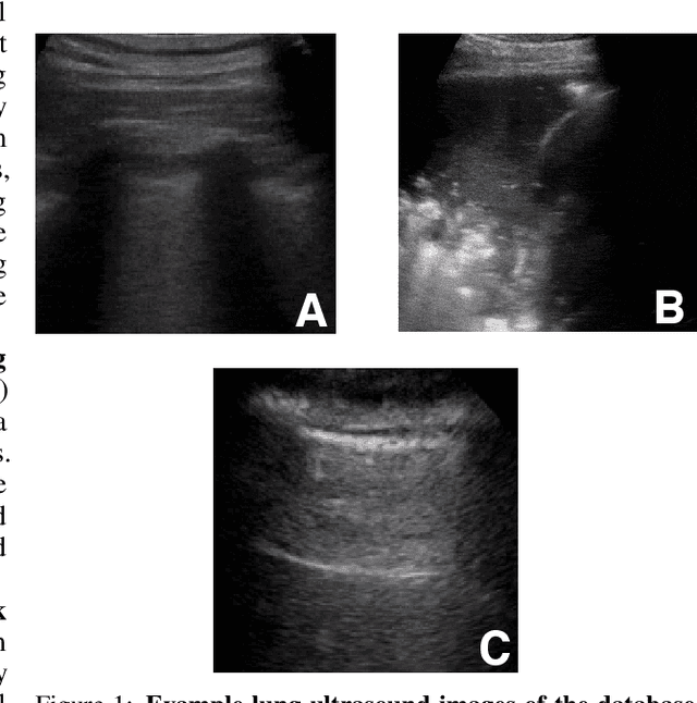 Figure 1 for POCOVID-Net: Automatic Detection of COVID-19 From a New Lung Ultrasound Imaging Dataset