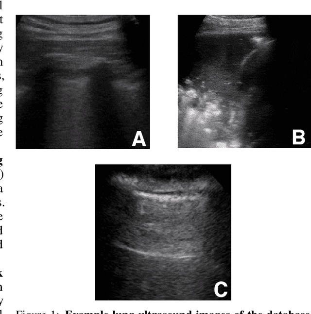 Figure 1 for POCOVID-Net: Automatic Detection of COVID-19 From a New Lung Ultrasound Imaging Dataset (POCUS)