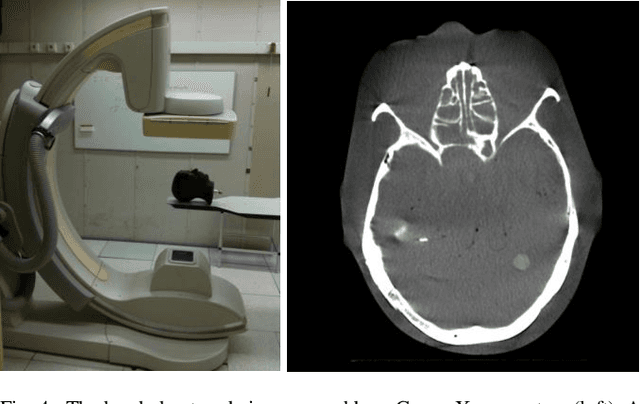 Figure 4 for Automatic 2D-3D Registration without Contrast Agent during Neurovascular Interventions