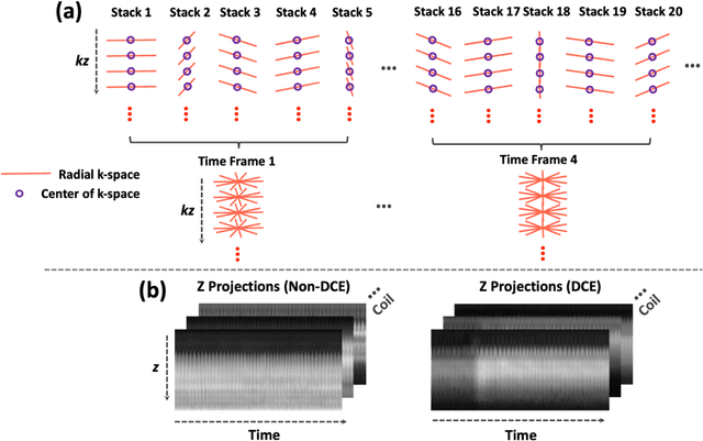 Figure 1 for 4D Real-Time GRASP MRI at Sub-Second Temporal Resolution