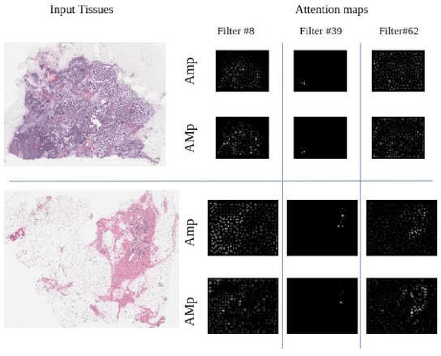 Figure 4 for Gigapixel Histopathological Image Analysis using Attention-based Neural Networks