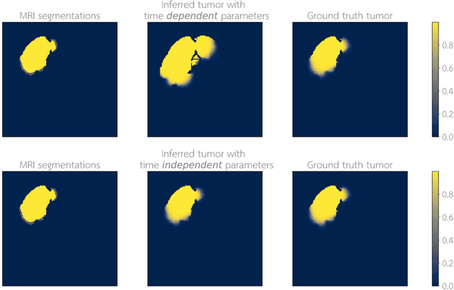 Figure 4 for Learn-Morph-Infer: a new way of solving the inverse problem for brain tumor modeling