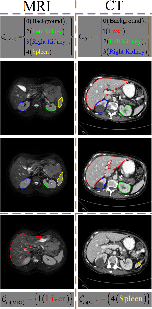 Figure 1 for Few-shot Medical Image Segmentation using a Global Correlation Network with Discriminative Embedding