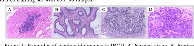 Figure 1 for Active Learning for Breast Cancer Identification