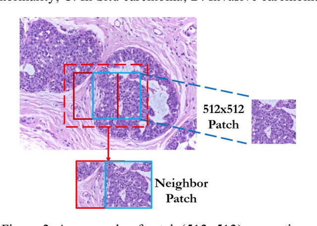 Figure 3 for Active Learning for Breast Cancer Identification