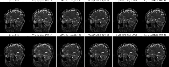 Figure 3 for Deep Image Prior using Stein's Unbiased Risk Estimator: SURE-DIP