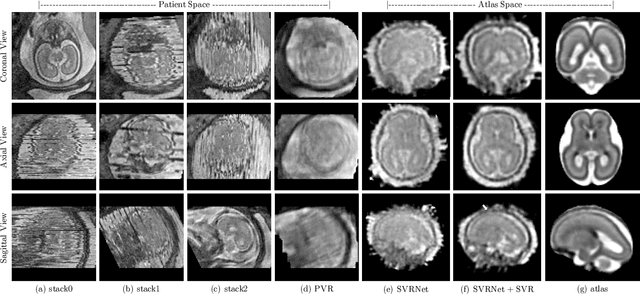 Figure 2 for 3D Reconstruction in Canonical Co-ordinate Space from Arbitrarily Oriented 2D Images