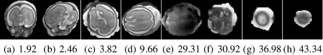 Figure 3 for 3D Reconstruction in Canonical Co-ordinate Space from Arbitrarily Oriented 2D Images