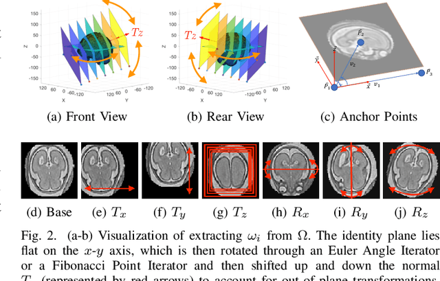 Figure 4 for 3D Reconstruction in Canonical Co-ordinate Space from Arbitrarily Oriented 2D Images