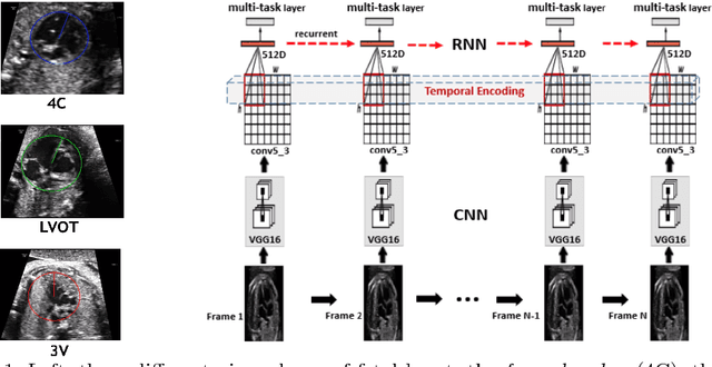 Figure 1 for Temporal HeartNet: Towards Human-Level Automatic Analysis of Fetal Cardiac Screening Video