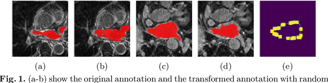 Figure 3 for Decoupling Predictions in Distributed Learning for Multi-Center Left Atrial MRI Segmentation