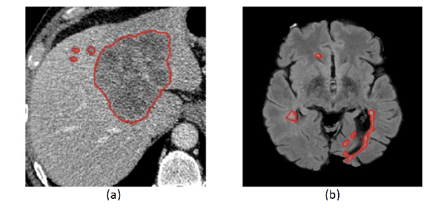 Figure 3 for Hyper-Convolutions via Implicit Kernels for Medical Imaging