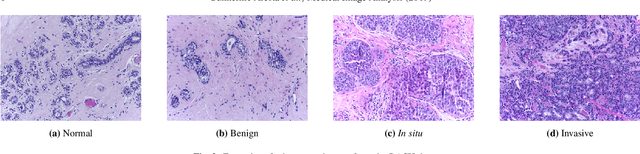 Figure 3 for BACH: Grand Challenge on Breast Cancer Histology Images