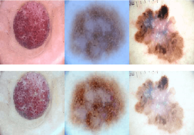 Figure 3 for Dermoscopic Image Classification with Neural Style Transfer