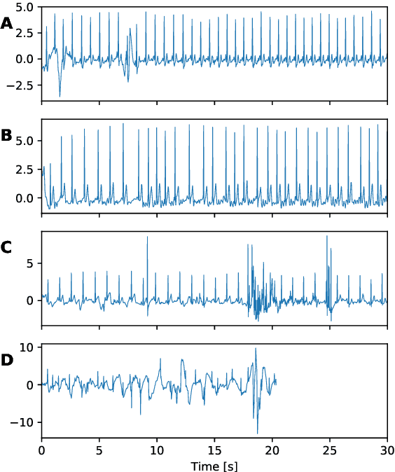 Figure 3 for Classification of Cardiac Arrhythmias from Single Lead ECG with a Convolutional Recurrent Neural Network