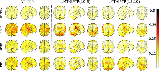 Figure 3 for Scalable Multi-Task Gaussian Process Tensor Regression for Normative Modeling of Structured Variation in Neuroimaging Data