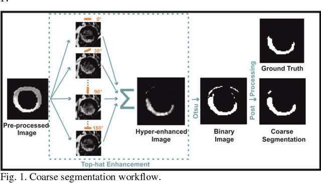 Figure 1 for Myocardial Infarction Quantification From Late Gadolinium Enhancement MRI Using Top-hat Transforms and Neural Networks