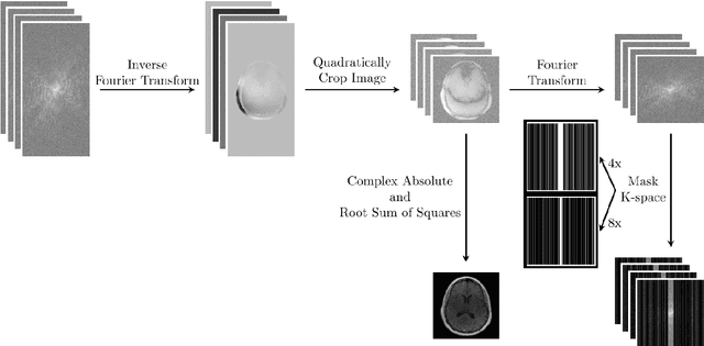 Figure 3 for A Densely Interconnected Network for Deep Learning Accelerated MRI