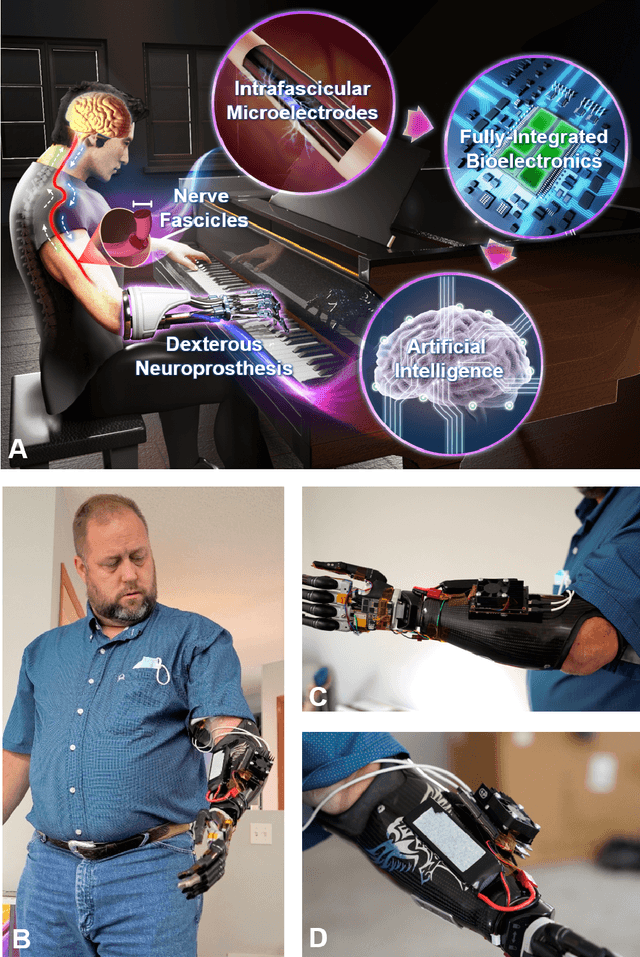 Figure 1 for A Portable, Self-Contained Neuroprosthetic Hand with Deep Learning-Based Finger Control