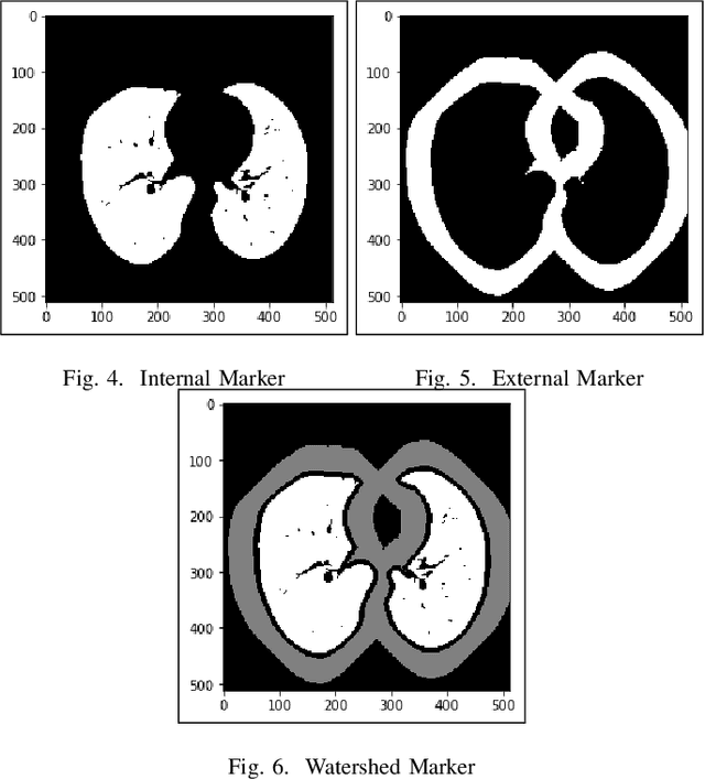 Figure 3 for Lung Cancer Detection and Classification based on Image Processing and Statistical Learning