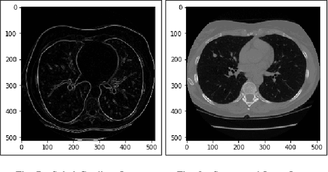 Figure 4 for Lung Cancer Detection and Classification based on Image Processing and Statistical Learning