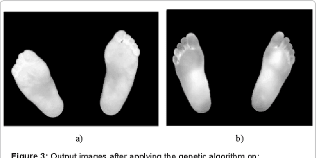 Figure 3 for Alternative Technique to Asymmetry Analysis-Based Overlapping for Foot Ulcer Examination: Scalable Scanning