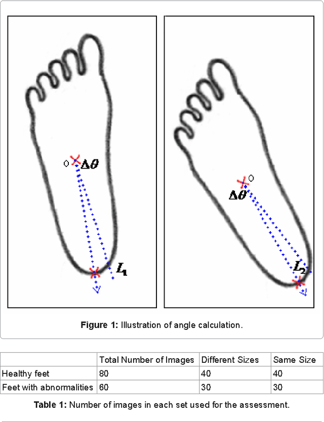 Figure 1 for Alternative Technique to Asymmetry Analysis-Based Overlapping for Foot Ulcer Examination: Scalable Scanning