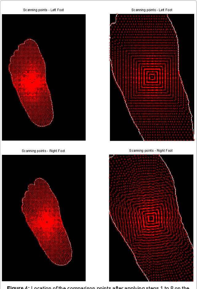 Figure 4 for Alternative Technique to Asymmetry Analysis-Based Overlapping for Foot Ulcer Examination: Scalable Scanning