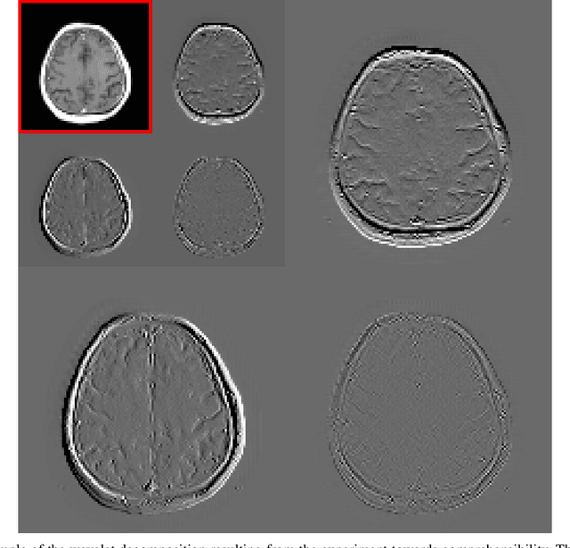 Figure 4 for Multi-modal Deep Guided Filtering for Comprehensible Medical Image Processing