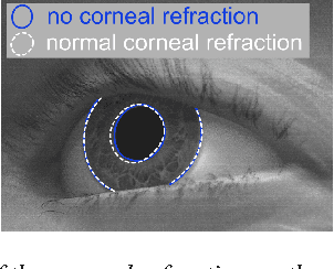 Figure 4 for Rendering refraction and reflection of eyeglasses for synthetic eye tracker images
