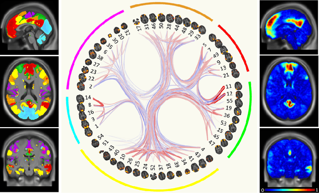 Figure 4 for Graph Saliency Maps through Spectral Convolutional Networks: Application to Sex Classification with Brain Connectivity