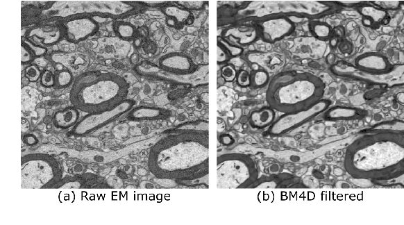 Figure 2 for gACSON software for automated segmentation and morphology analyses of myelinated axons in 3D electron microscopy
