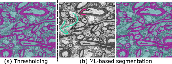 Figure 4 for gACSON software for automated segmentation and morphology analyses of myelinated axons in 3D electron microscopy