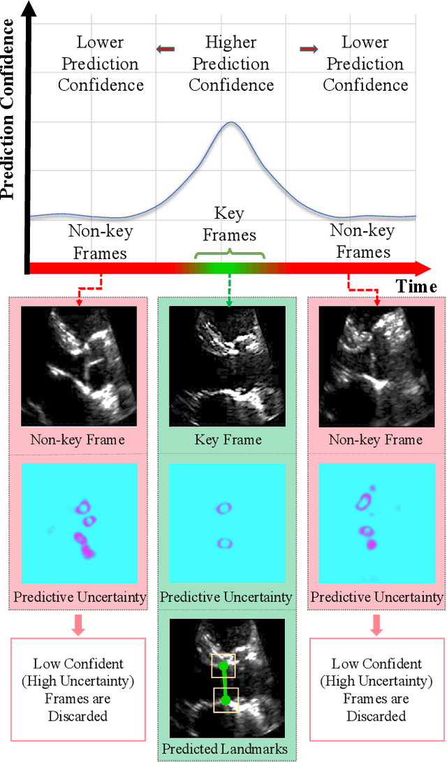 Figure 1 for U-LanD: Uncertainty-Driven Video Landmark Detection