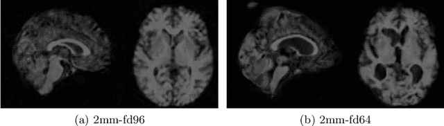 Figure 4 for 3D-StyleGAN: A Style-Based Generative Adversarial Network for Generative Modeling of Three-Dimensional Medical Images