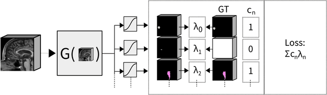 Figure 1 for Exploiting Clinically Available Delineations for CNN-based Segmentation in Radiotherapy Treatment Planning