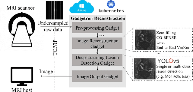 Figure 1 for End-to-End AI-based MRI Reconstruction and Lesion Detection Pipeline for Evaluation of Deep Learning Image Reconstruction