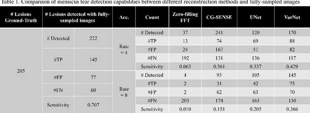 Figure 2 for End-to-End AI-based MRI Reconstruction and Lesion Detection Pipeline for Evaluation of Deep Learning Image Reconstruction