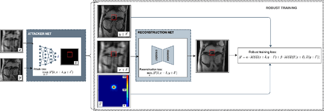 Figure 1 for Adversarial Robust Training in MRI Reconstruction
